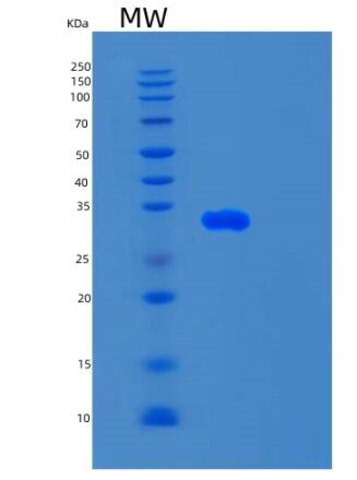 Recombinant Human SMUG1 Protein,Recombinant Human SMUG1 Protein