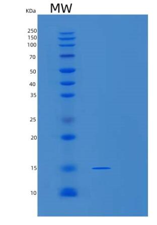 Recombinant Human SNRPD2 Protein,Recombinant Human SNRPD2 Protein