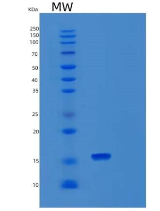 Recombinant Human SNRPD3 Protein,Recombinant Human SNRPD3 Protein