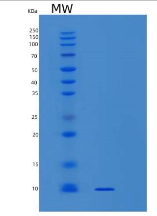 Recombinant Human SNRPG Protein,Recombinant Human SNRPG Protein