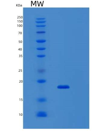 Recombinant Human SNTN Protein,Recombinant Human SNTN Protein