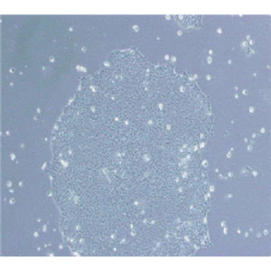 Nthy-ori3-1细胞,Nthy-ori3-1