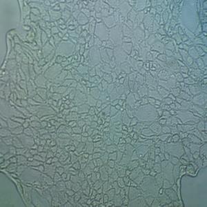 L615小鼠网织细胞性白血病细胞