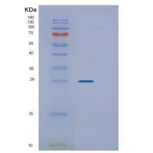 Recombinant Human SLAMF1 Protein,Recombinant Human SLAMF1 Protein