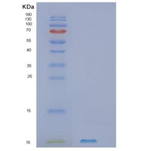 Recombinant Human SLC51B Protein,Recombinant Human SLC51B Protein