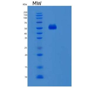 Recombinant Human SNTA1 Protein,Recombinant Human SNTA1 Protein