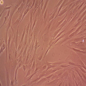 NCI-H1975/RFP人非小细胞肺腺癌细胞,NCI-H1975/RFP