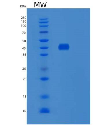 Recombinant Human SNX5 Protein,Recombinant Human SNX5 Protein