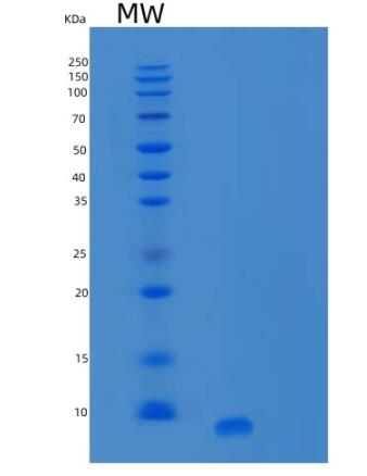 Recombinant Human SPINK1 Protein,Recombinant Human SPINK1 Protein