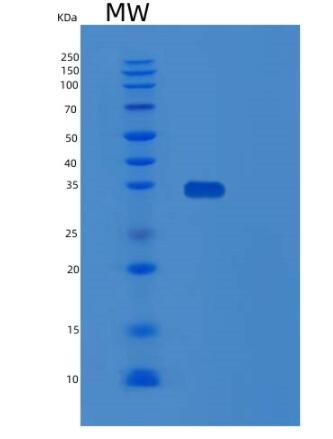 Recombinant Human SPRY4 Protein,Recombinant Human SPRY4 Protein