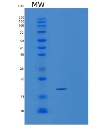 Recombinant Human SRP19 Protein,Recombinant Human SRP19 Protein