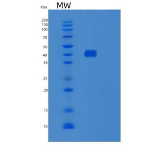 Recombinant Human SNX5 Protein