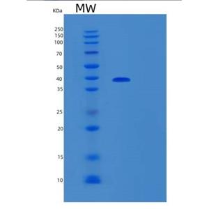 Recombinant Human SORBS3 Protein,Recombinant Human SORBS3 Protein