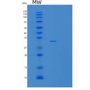 Recombinant Human SPIN1 Protein,Recombinant Human SPIN1 Protein