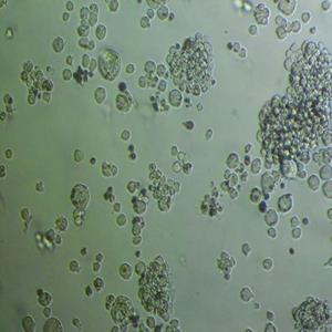 NCI-H1975/GFP人非小细胞肺腺癌细胞