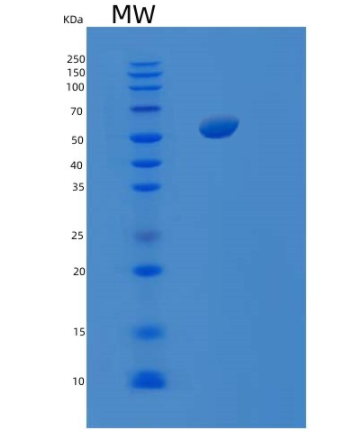 Recombinant E.coli SRS (Seryl-tRNA synthetase) Protein,Recombinant E.coli SRS (Seryl-tRNA synthetase) Protein