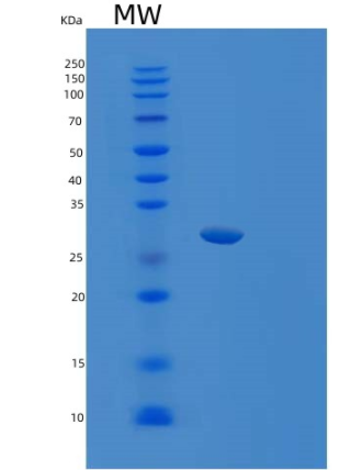 Recombinant Human SRSF1 Protein,Recombinant Human SRSF1 Protein