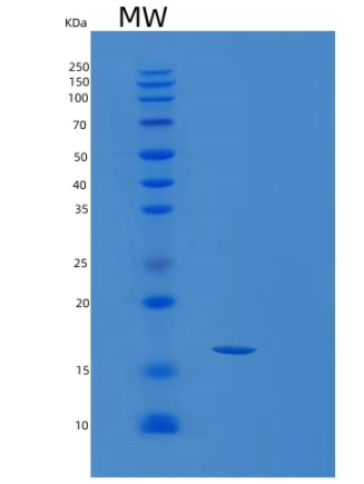 Recombinant Human SSBP1 Protein,Recombinant Human SSBP1 Protein