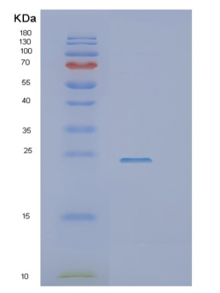 Recombinant Human SSR1 Protein,Recombinant Human SSR1 Protein