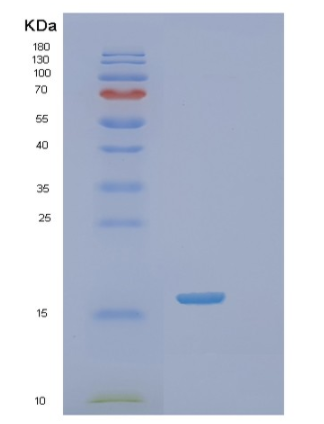 Recombinant Human SSR2 Protein,Recombinant Human SSR2 Protein