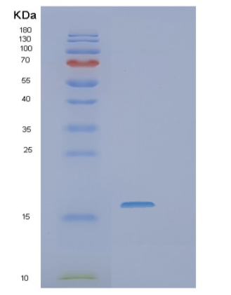 Recombinant Human SSR4 Protein,Recombinant Human SSR4 Protein