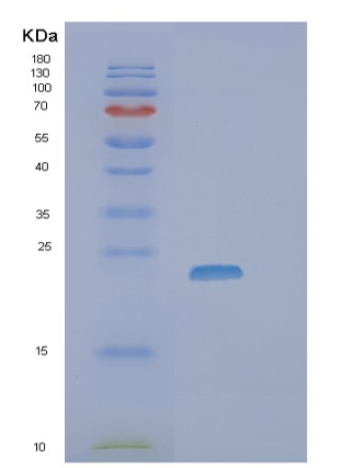 Recombinant Human SSSCA1 Protein,Recombinant Human SSSCA1 Protein