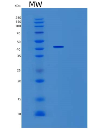 Recombinant Human ST3GAL5 Protein,Recombinant Human ST3GAL5 Protein