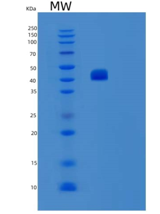 Recombinant Human ST6GAL1 Protein,Recombinant Human ST6GAL1 Protein