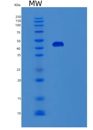 Recombinant Human STAC Protein,Recombinant Human STAC Protein