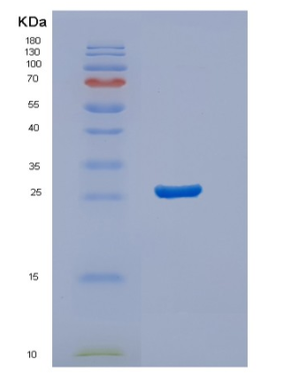 Recombinant Human STARD5 Protein,Recombinant Human STARD5 Protein
