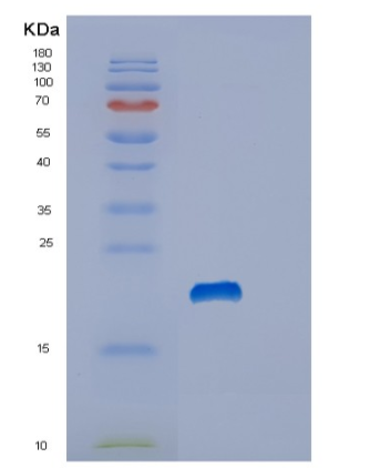 Recombinant Human Stathmin Protein,Recombinant Human Stathmin Protein