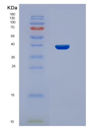 Recombinant Human STBD1 Protein,Recombinant Human STBD1 Protein