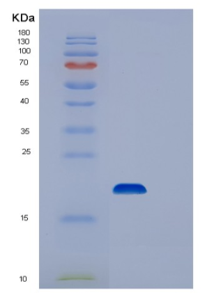 Recombinant Human STEAP4 Protein,Recombinant Human STEAP4 Protein