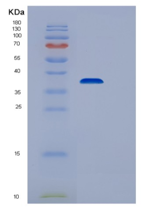 Recombinant Human STIM1 Protein,Recombinant Human STIM1 Protein