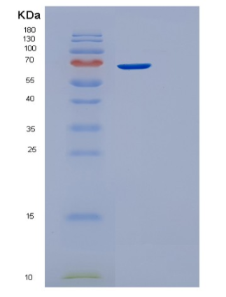 Recombinant Human STIP1 Protein,Recombinant Human STIP1 Protein