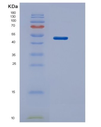 Recombinant Human STK11 Protein,Recombinant Human STK11 Protein