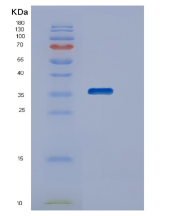 Recombinant Human STK16 Protein,Recombinant Human STK16 Protein