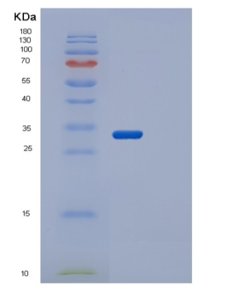 Recombinant Human STK17A Protein,Recombinant Human STK17A Protein