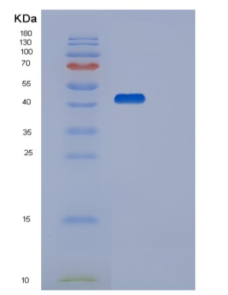 Recombinant Human STK17B Protein,Recombinant Human STK17B Protein