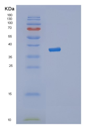 Recombinant Human STK3 Protein,Recombinant Human STK3 Protein