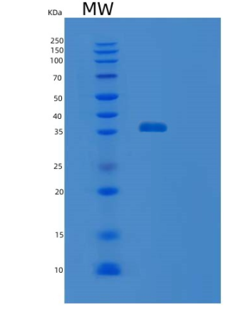 Recombinant Human STOML1 Protein,Recombinant Human STOML1 Protein