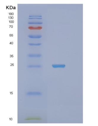 Recombinant Human STXBP6 Protein,Recombinant Human STXBP6 Protein