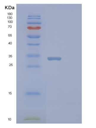 Recombinant Human STYX Protein,Recombinant Human STYX Protein