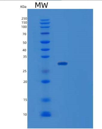 Recombinant Human SUGT1 Protein,Recombinant Human SUGT1 Protein