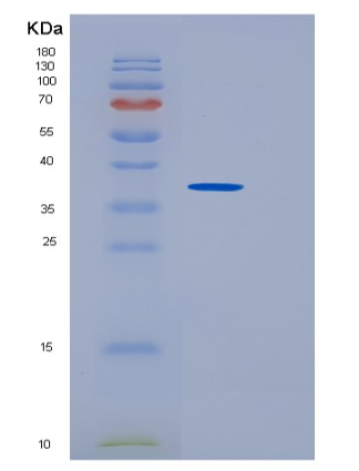 Recombinant Human SULT1B1 Protein,Recombinant Human SULT1B1 Protein