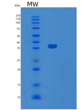 Recombinant Human SULT1C4 1-302aa Protein,Recombinant Human SULT1C4 1-302aa Protein