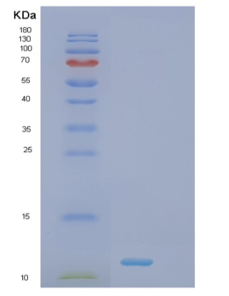 Recombinant Human SUMO1 Protein,Recombinant Human SUMO1 Protein