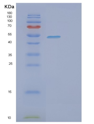Recombinant Human SUOX Protein,Recombinant Human SUOX Protein