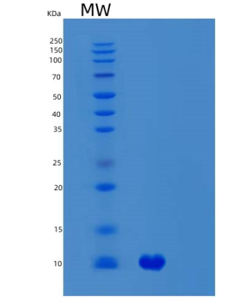 Recombinant Human SVIP Protein,Recombinant Human SVIP Protein