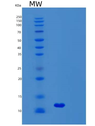 Recombinant Human SYCE3 Protein,Recombinant Human SYCE3 Protein